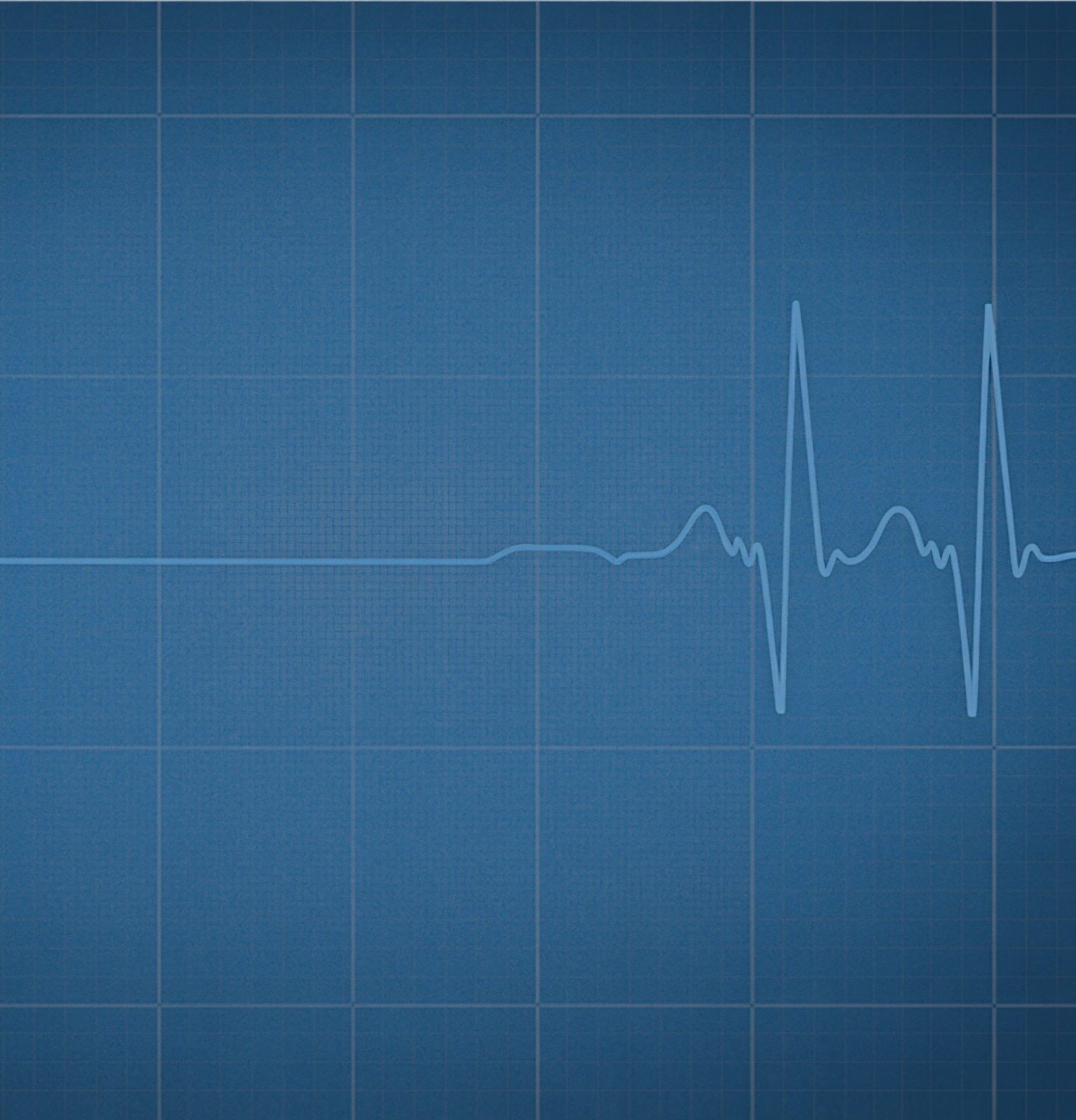 A,Blue,Background,With,A,White,Electrocardiogram,Line,Showing,A